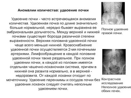 Сколько аномалий