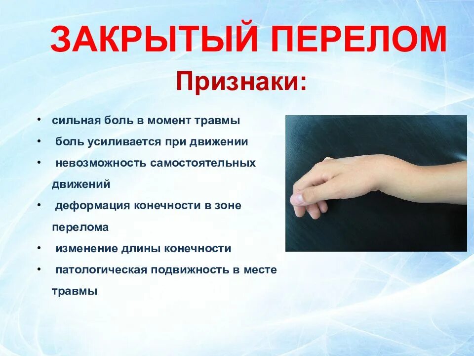 Признаки переломов у детей. Симптомы закрытого перелома. признакизаткрытого перелома. признакизакрытого перелрма. назовите признаки закрытого перелома.
