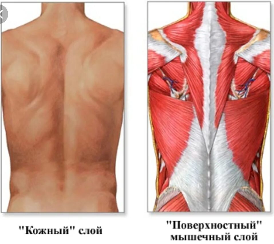 Болит спина отеки. Воспаление мышечной ткани (миозит). Воспаление мышц позвоночника. Воспаление спинной мышцы.