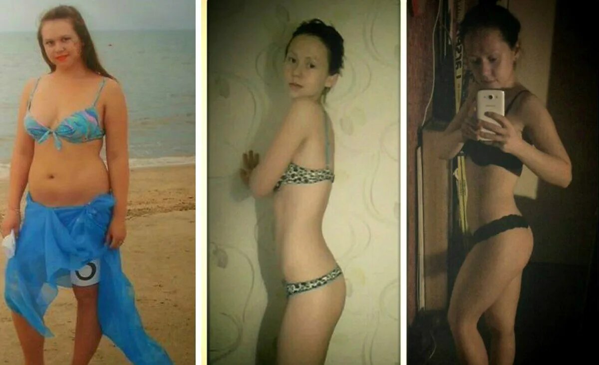 Можно убрать живот с помощью обруча. Обруч для похудения до и после. результат от обруча до и после. занятие с хулахупом до и после. хулахуп для похудения до и после.