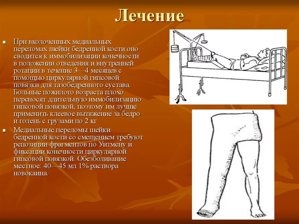 при переломе немеет рука. при переломе немеет рука. лечебная физкультура при невропатии локтевого нерва упражнения. при переломе немеет рука. лучевая кость на руке перелом.