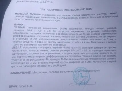 Узи мвс