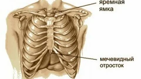 Воспаление мечевидного отростка грудины