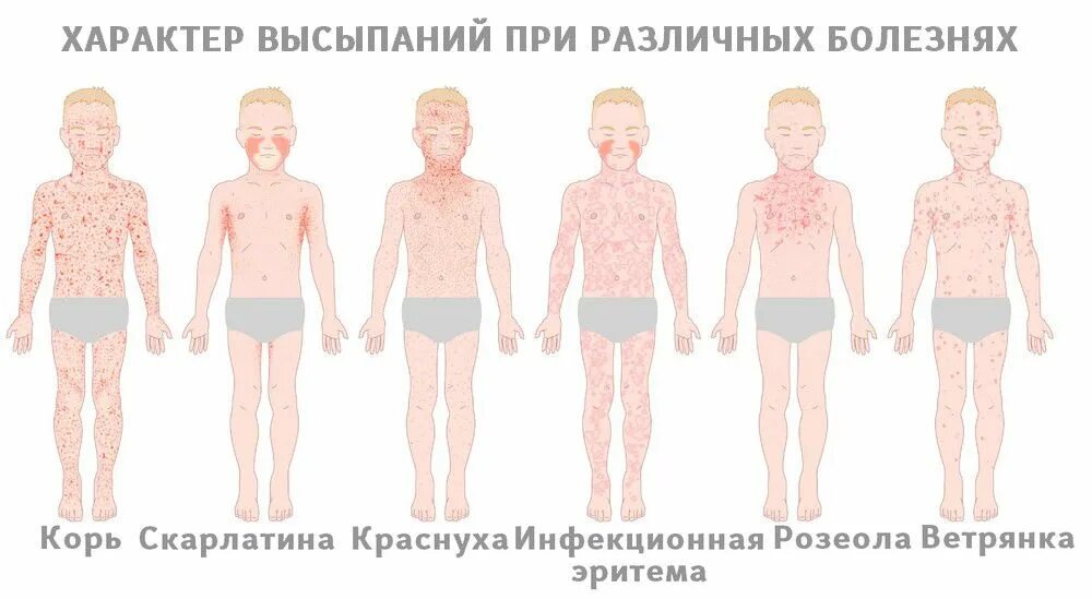 Формы сыпи
