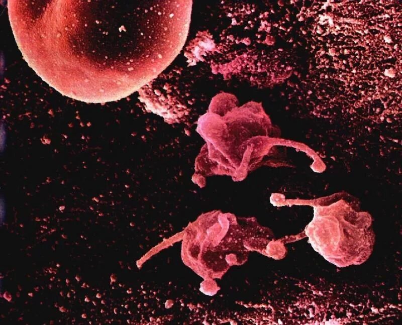 Chlamydia trachomatis mycoplasma genitalium. Уреаплазмоз и микоплазмоз. Мочеполовой микоплазмоз возбудитель.