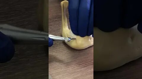 Фиксация мембран