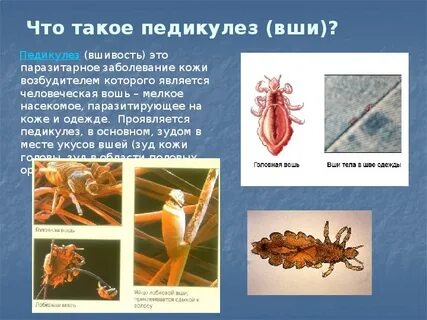 Чесотка и педикулез