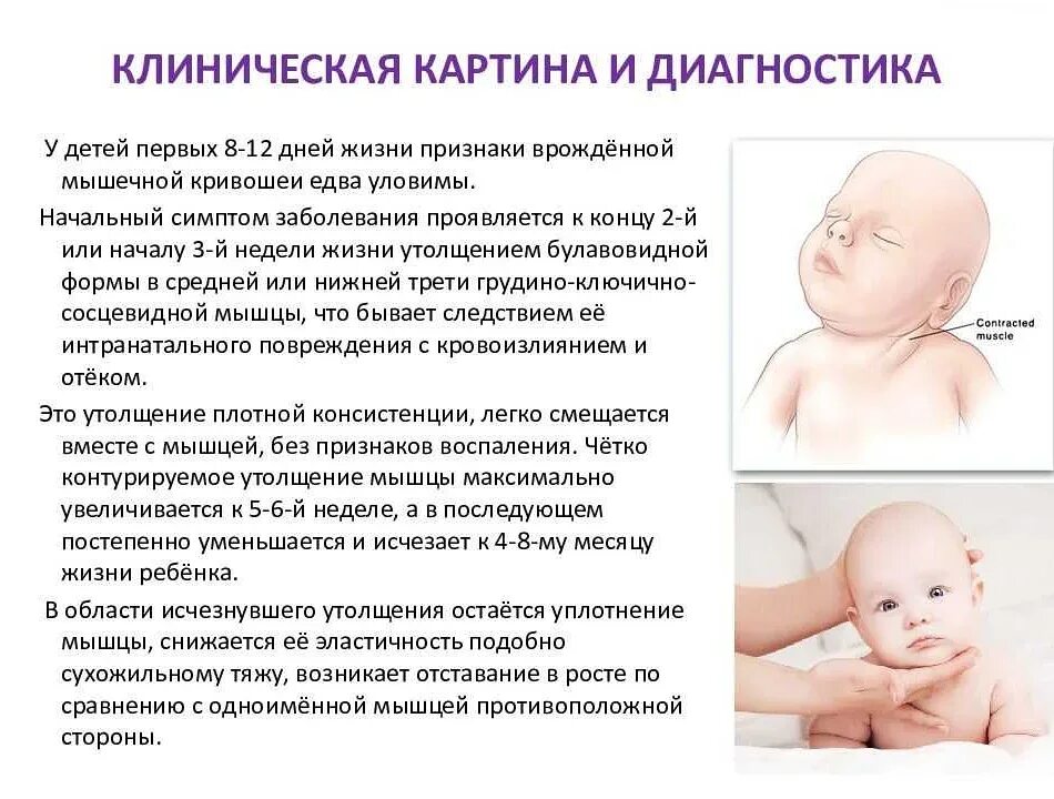 Восеолткр ребёнок держит голову. В каком возрасте ребенок держит голову. Новорожденный и месячный ребенок. Почему новорожденный издает звуки. Когда ребенок начинает держать голову.