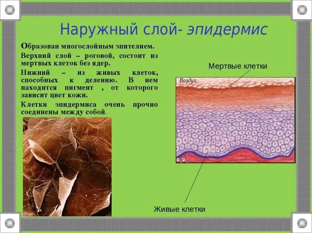 Пигмент содержащийся в коже. Клетки эпидермиса кожи человека. Наружный слой эпидермиса. Наружный слой кожи эпидермис. Наружный роговой слой кожи.