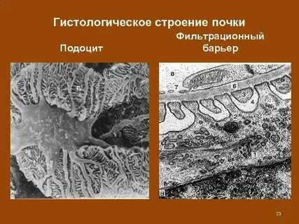Почечный барьер