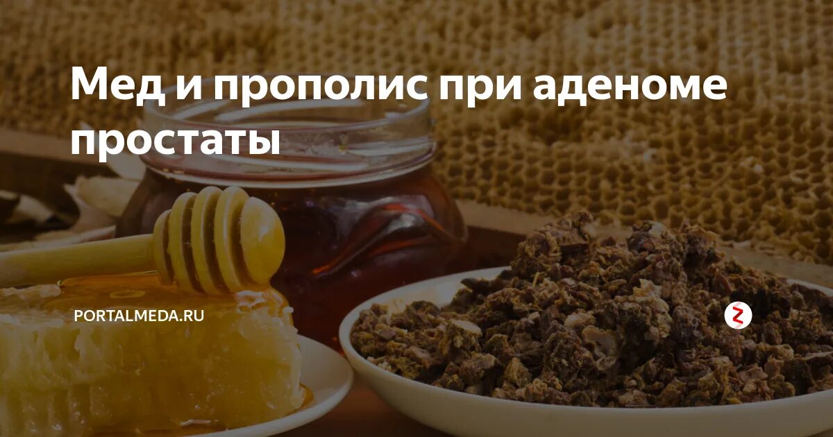 Прополис простата. Прополис при аденоме. прополис при простатите. прополис с медом при онкологии.