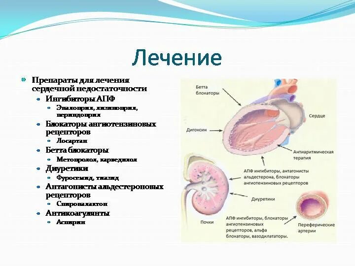 При хронической сердечной недостаточности применяют препараты. Терапия сердечной недостаточности. ЯЛЕЧЕНИЕ сердечной НЕДОМТ. Терапия при сердечной недостаточности. Сердечная недостаточность лечение народными