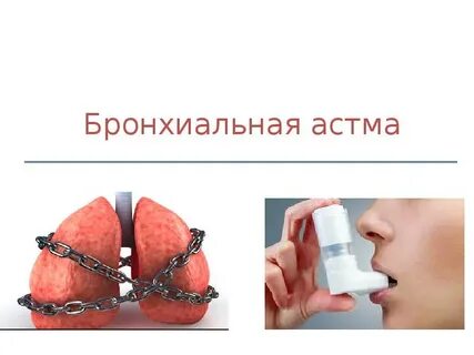 Астма реферат