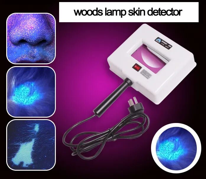 Лампа вуда олдд-01. Микроспория свечение под лампой вуда. Светильник альфа + лампа (аналог. Лампа вуду. Лампа вуда желтый.