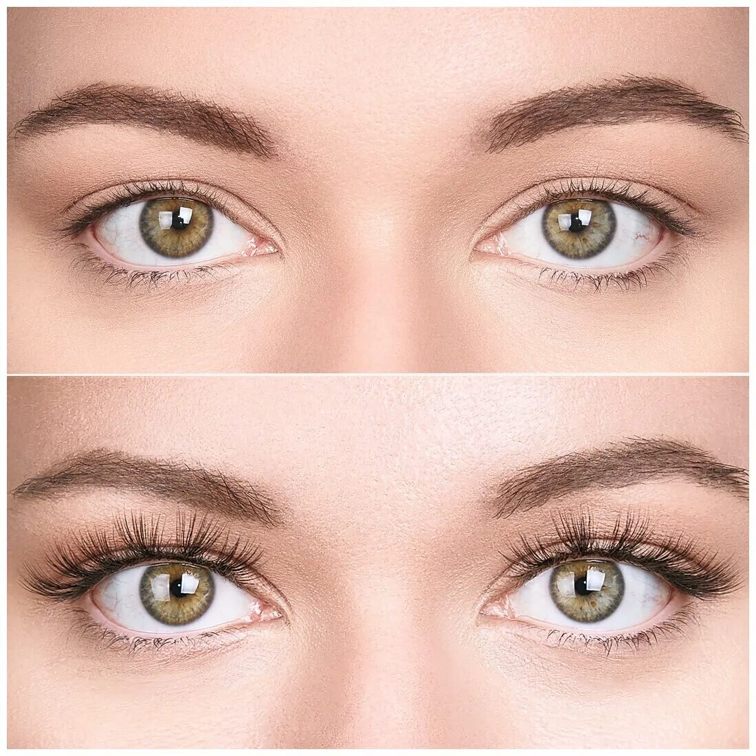 морщины вокруг глаз до и после. Mesoeye c71. ультраформер на верхнее веко. глазами отзывы клиентов. плазменная блефаропластика.