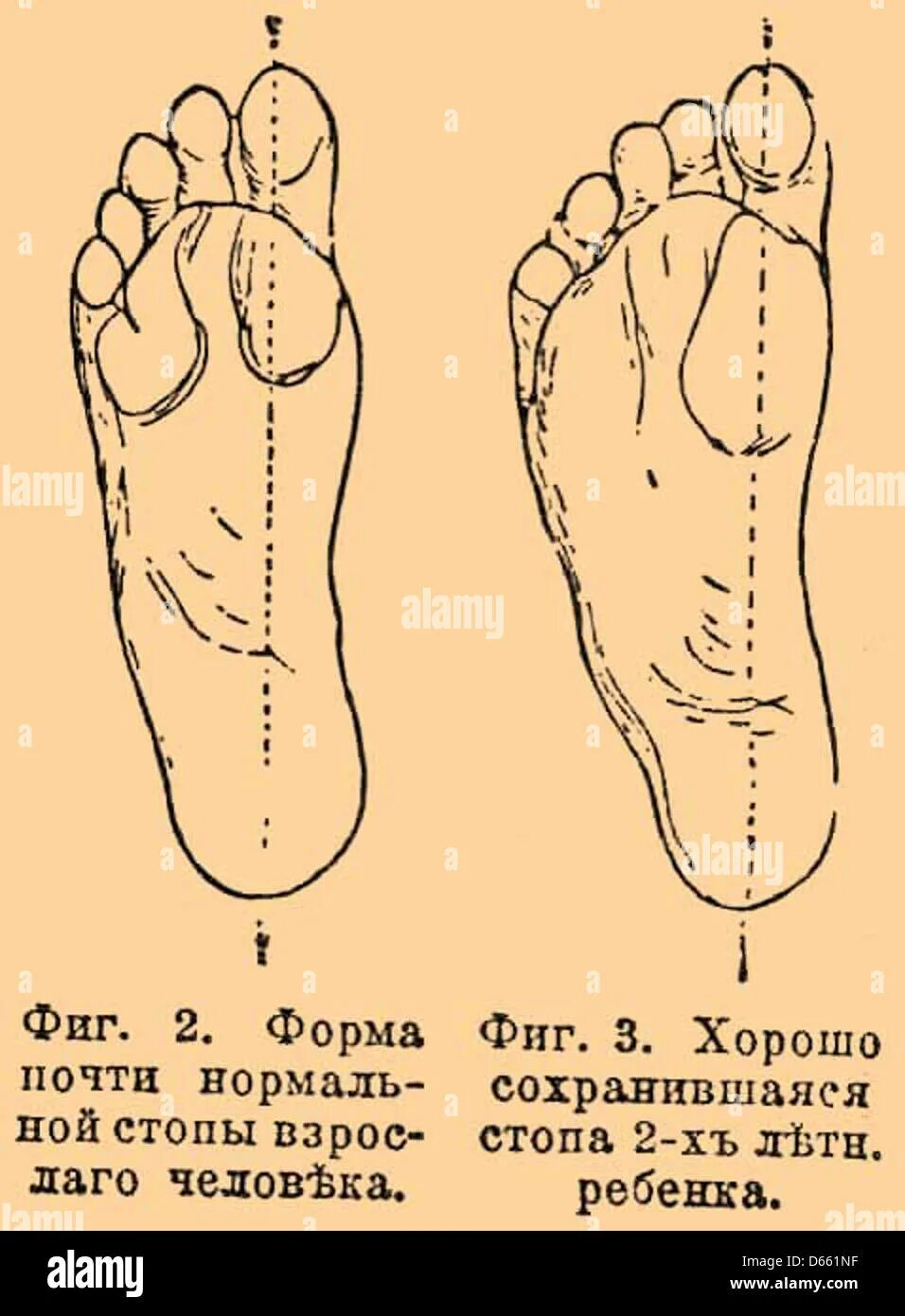Типы стопы человека. Форма стопы. Правильный вид стопы. Нормальная форма стопы. Форма женской стопы.