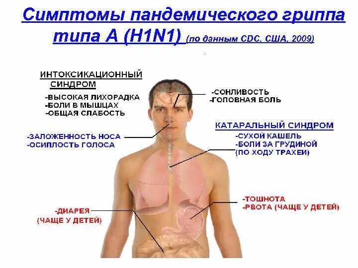 Грипп h1n1 симптомы. Грипп типа а/h1n1. Симптомы гриппа. Признаки пандемии.