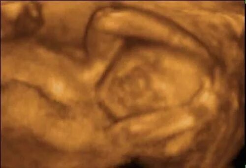 Видео 20 недель. Снимок УЗИ плода 20 недель. 20 Недель беременности фото плода на УЗИ.