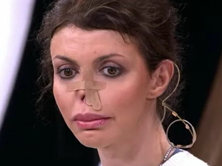 Жена аршавина алиса казьмина болезнь. Алиса аршавина с новым носом. Алиса казьмина. Алиса казьмина сейчас 2021. Жена аршавина 2022.