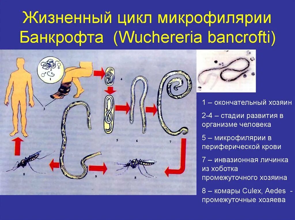 Wuchereria bancrofti инвазионная стадия. Wuchereria bancrofti жизненный цикл. Нитчатка Банкрофта цикл развития. Схема цикла развития нитчатки Банкрофта.