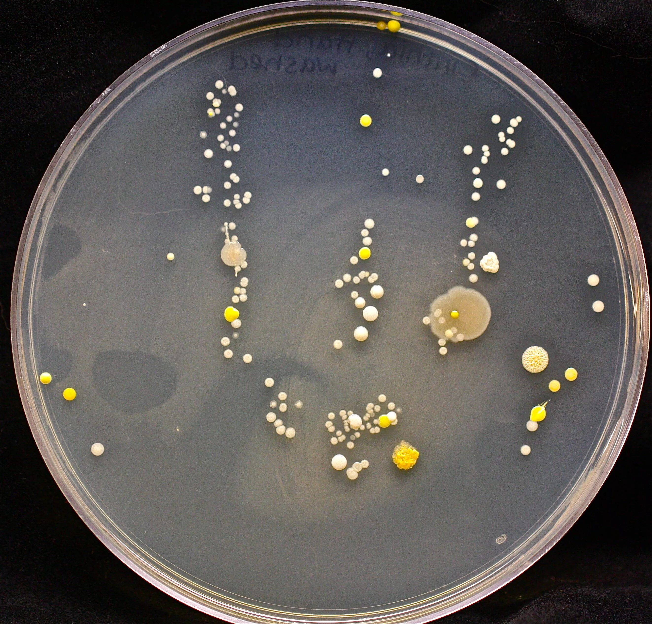 Стафилококк в чашке Петри. Золотистый стафилококк на чашке Петри. Staphylococcus epidermidis на чашке Петри. Микрококки сарцины. Стафилакока