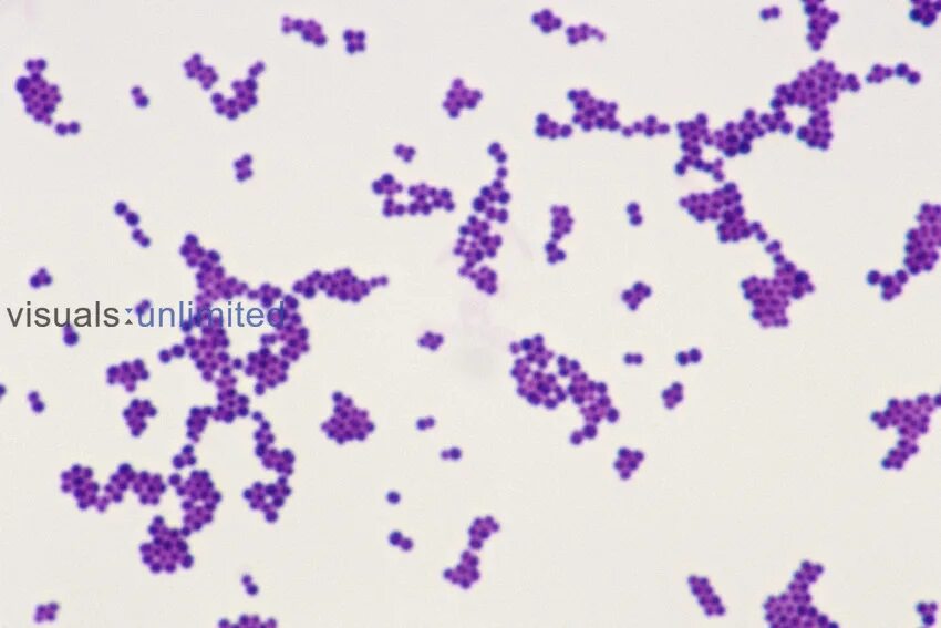 Micrococcus luteus микробиология. Стафилококк ауреус в мазке. Стафилококк мазок по граму. Стрептококки факультативные анаэробы. Микроскопия мазка сарцины.