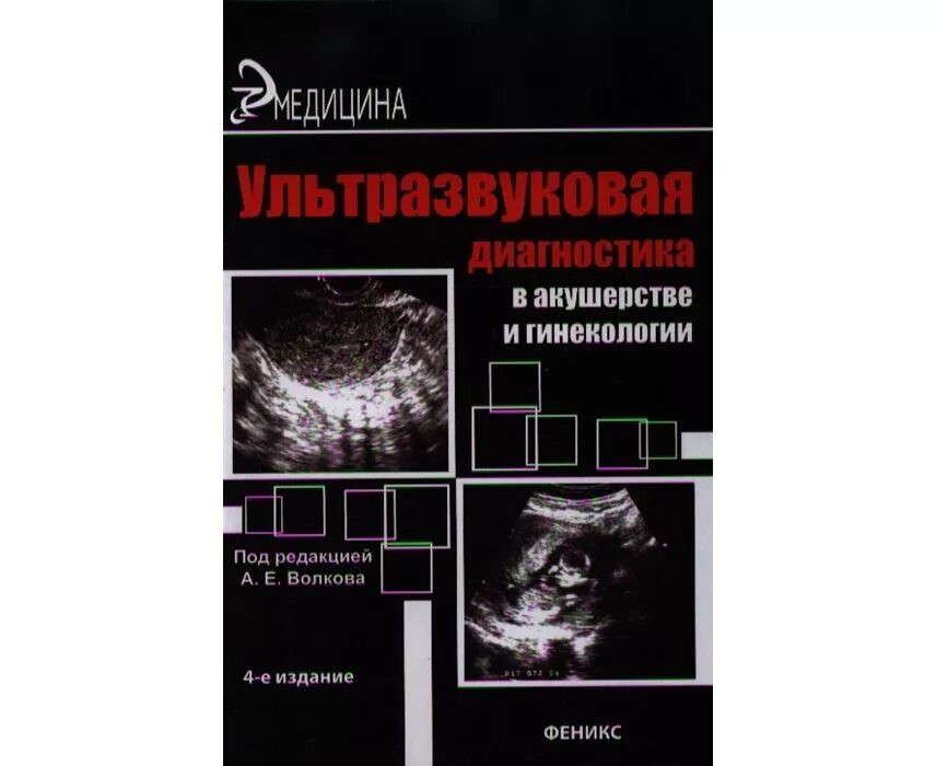 Ультразвуковая диагностика в акушерстве и гинекологии Волкова. УЗИ В акушерстве и гинекологии. УЗИ книга. Ультразвуковая диагностика книги