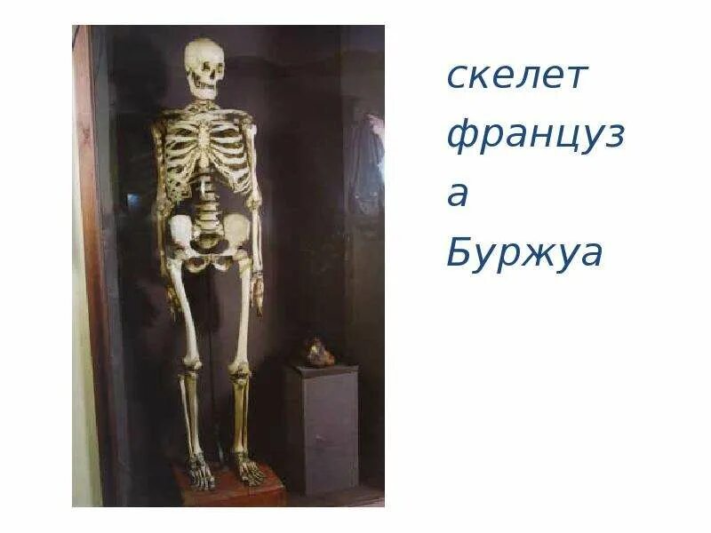 Почему король буржуа. Великан буржуа кунсткамера.