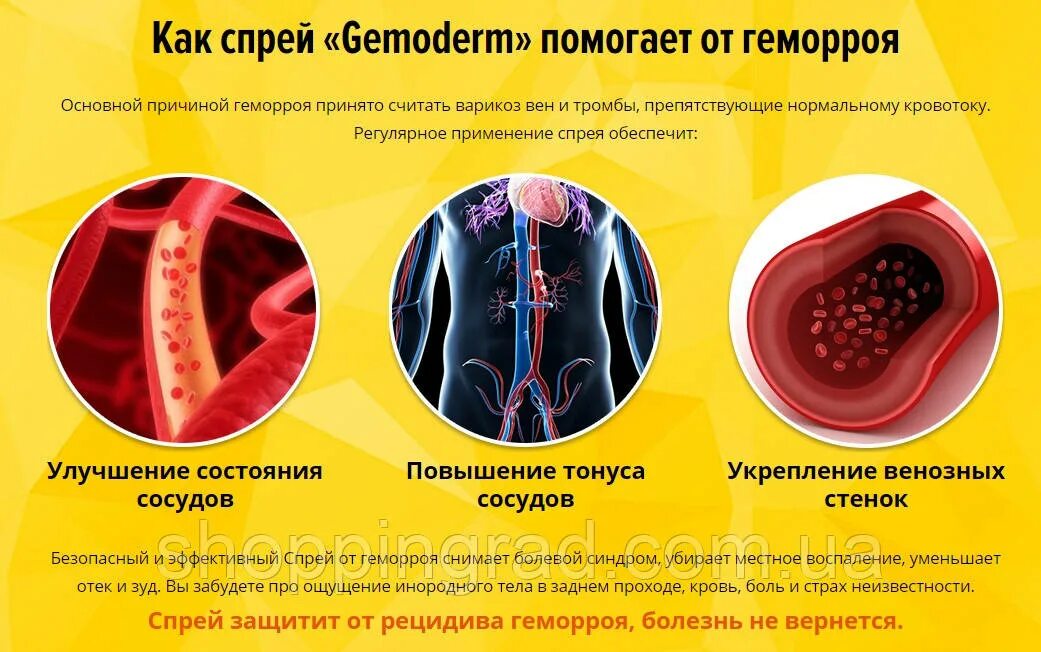 Почему зудит в заднем проходе. Геморроидальное кровотечение. Геморроидальная болезнь. Гемодерм спрей от геморроя.