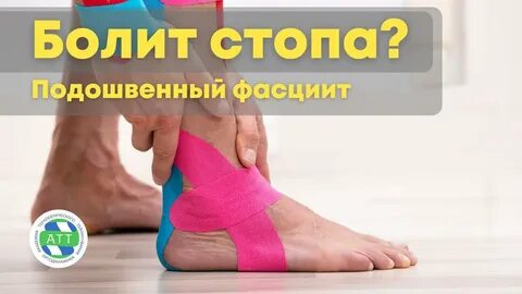 Тейпирование при фасциите