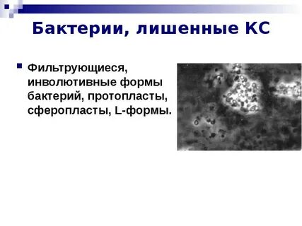 L формы