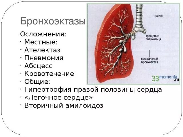 Как лечить бронхоэктазы. Осложнения бронхоэктазов. бронхоэктазы осложнения. бронхоэктаз и ателектаз. перечислить факторы, вызывающие образование бронхоэктазов.