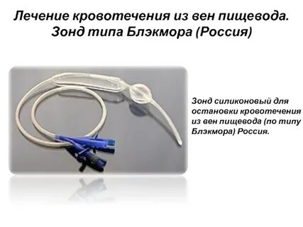 Зонд блэкмора для остановки кровотечения