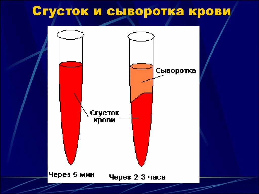 Плазма это кровь. Сыворотка крови. Получение сыворотки крови. Состав сыворотки крови. Плазма и сыворотка крови.