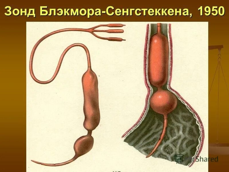 Кровотечение из желудка пищевода. Зонд Сенгстакена-Блэкмора. Зонд при кровотечении из варикозно расширенных вен пищевода. Зонд Блекмора при кровотечении. Баллонная тампонада зонд Блэкмора.