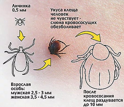 При присасывании клеща симптомы. Как выглядит место укусом клеща клеща.