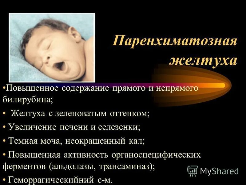 причины физиологической желтухи. степени гемолитической болезни новорожденного. физиологическая желтуха новорожденных патогенез. физиологическая желтуха у новорожденных показатели билирубина. физиологическая желтуха новорожденных показатели.