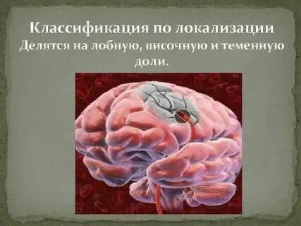 Инсульт лобной доли