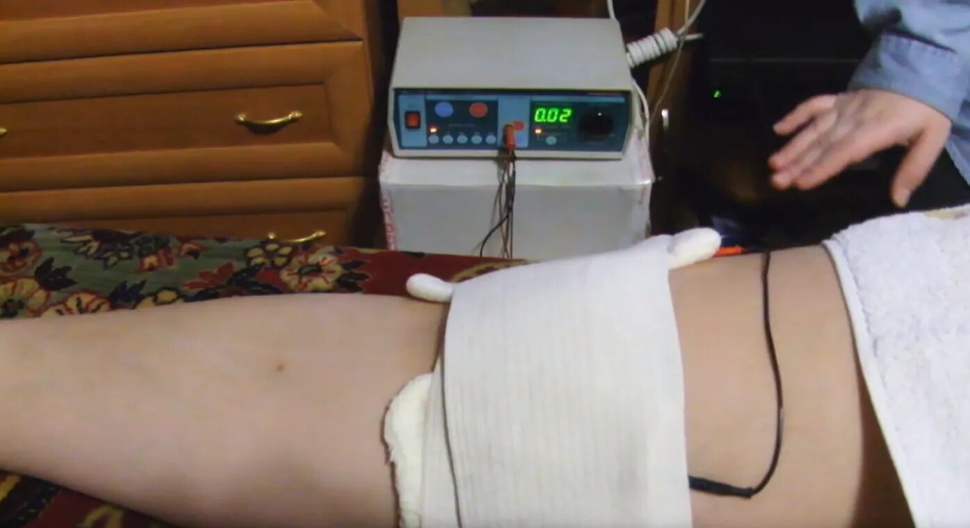 Электрофорез с новокаином на поясничный отдел. Электрофорез с новокаином на поясничный отдел. Электрофорез процедура. Амплипульс на поясничный отдел позвоночника. Электрофорез с новокаином на поясничный.