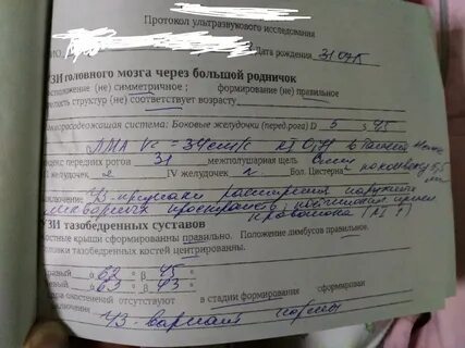 Узи головы калининград