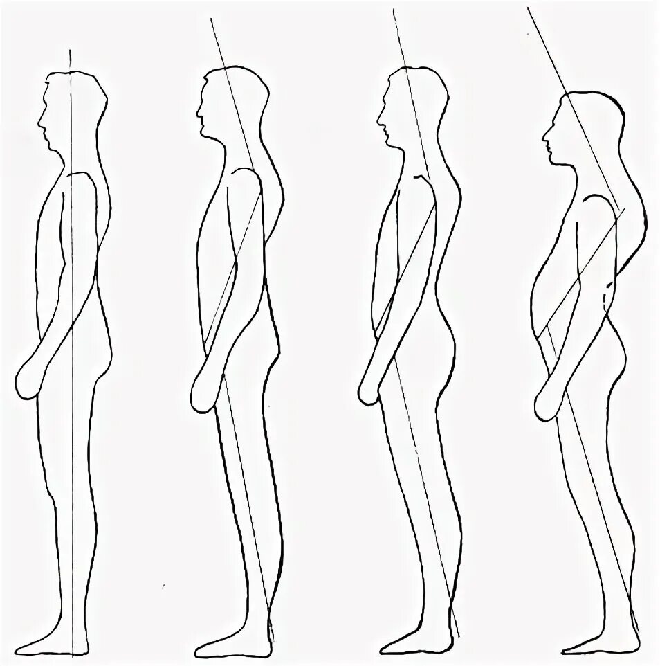 задания по пластической анатомии. основы пластики тела. реконструктивная пластическая хирургия. основы пластической анатомии библиотека. лифтинг лица.
