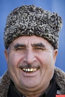 Азербайджанец с губой
