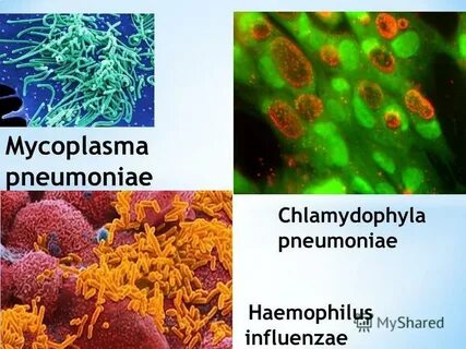 Chlamidia pneumonia