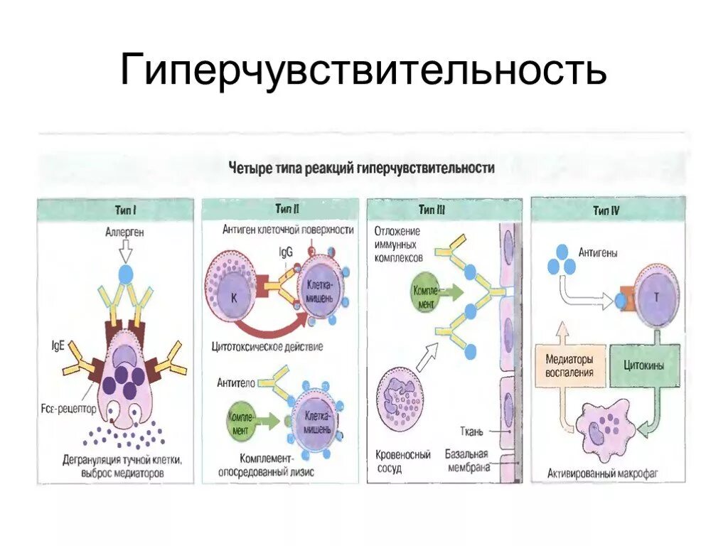 Иммунная гиперчувствительность. Схема реакции гиперчувствительности 1-го типа. Гиперчувствительность 1 типа схема. Механизмы развития реакции гиперчувствительности схема. Схема реакции гиперчувствительности 1 типа.