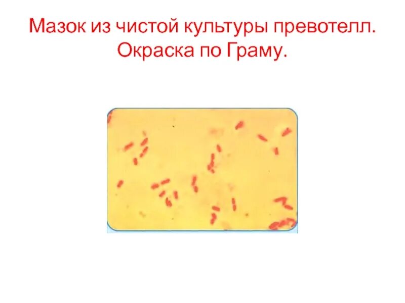 Prevotella что это такое у женщин