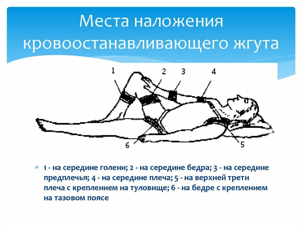 Как правильно наложить артериальный жгут. Наложение жгута Эсмарха на бедро. Правильное наложение жгута на бедро. Наложение резинового кровоостанавливающего жгута на бедро.