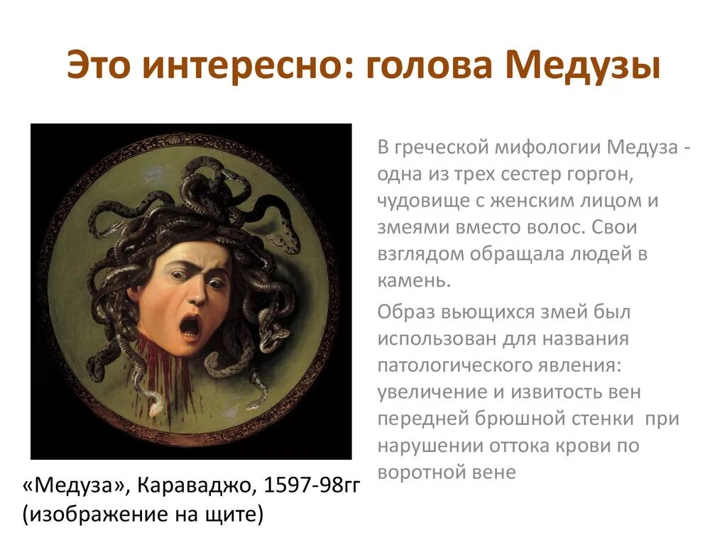 Синдром портальной гипертензии голова медузы. Синдром медузы. Синдром медузы. Синдром медузы. «голова медузы» (варикозное расширение подкожных вен в области пупка).