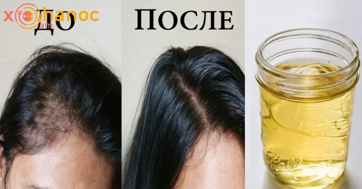 Помогает Ли Сперма В Росте Волос
