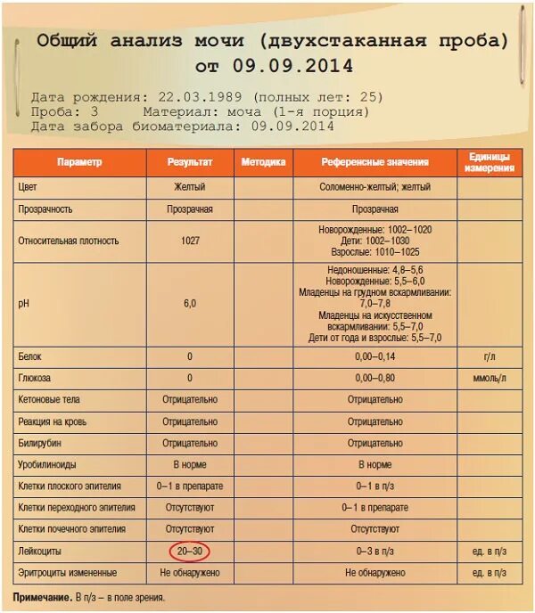 Анализ мочи трехстаканная проба расшифровка. Трехстаканная проба мочи норма. Анализ мочи норма. Исследование мочи общий анализ. Трехстаканная проба мочи