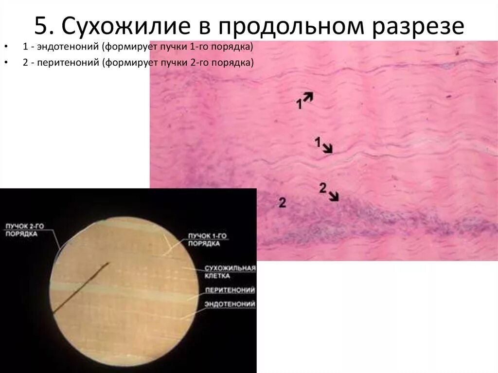 Плотносоединительная ткань гистология препарат. Сухожилие гистологический препарат. Сухожилие гистология препарат. Поперечный срез сухожилия препарат.